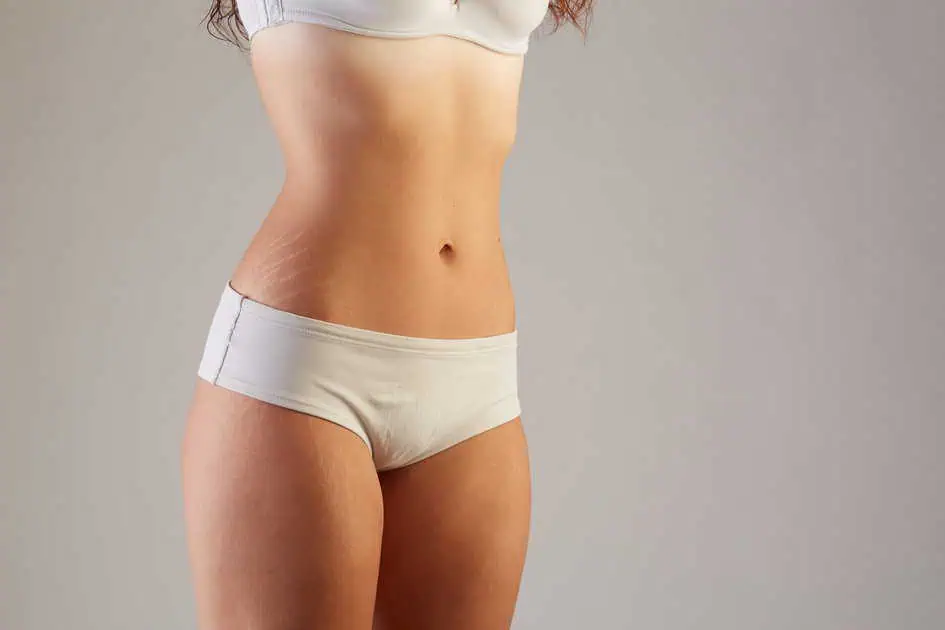 Stretch Mark Treatment in Medford, OR by The Aesthetic District